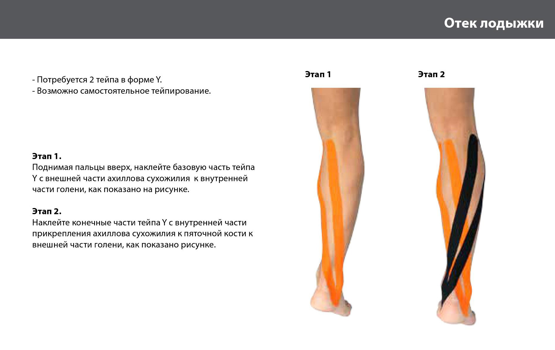 Тейпирование икроножной мышцы при судорогах схема