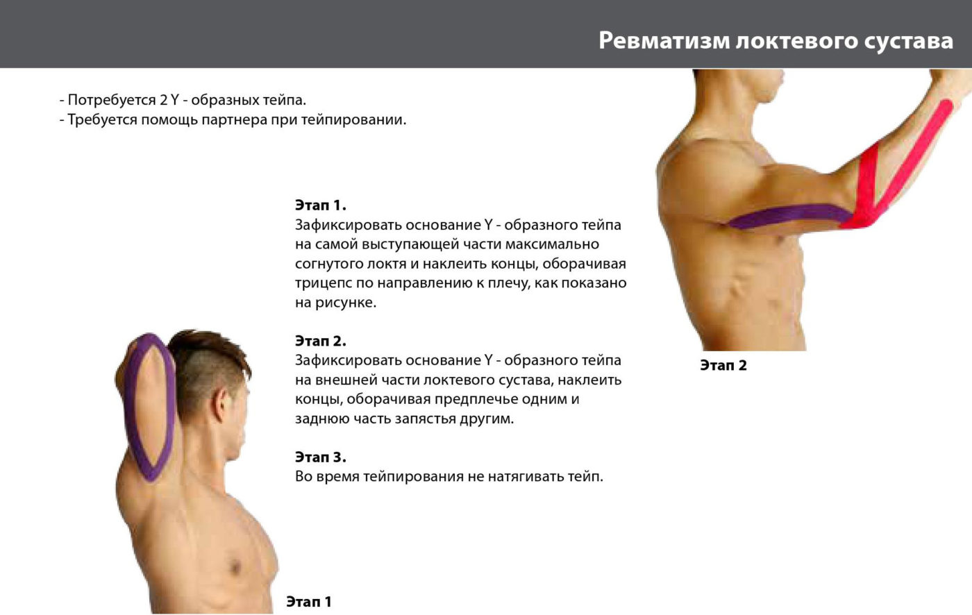 Ревматизм локтевого сустава - Кинезиологический тейп компании ARES