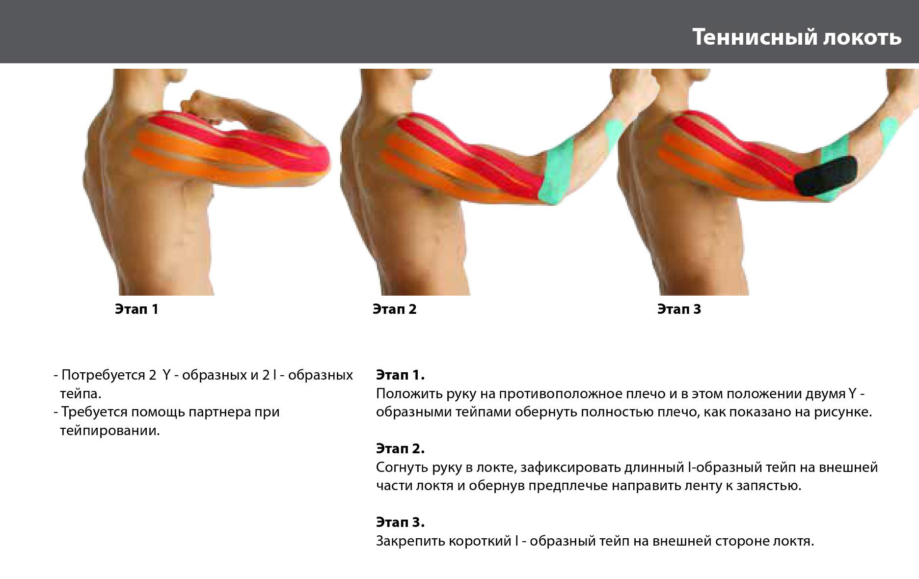 Тейп на плечевой сустав схема